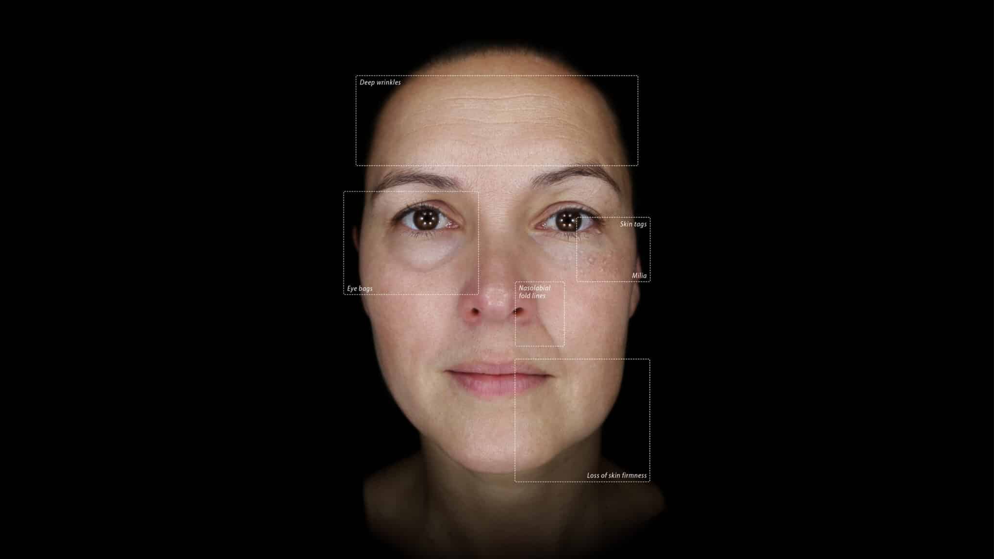 Alma IQ Daylight Mode Callouts scaled 1