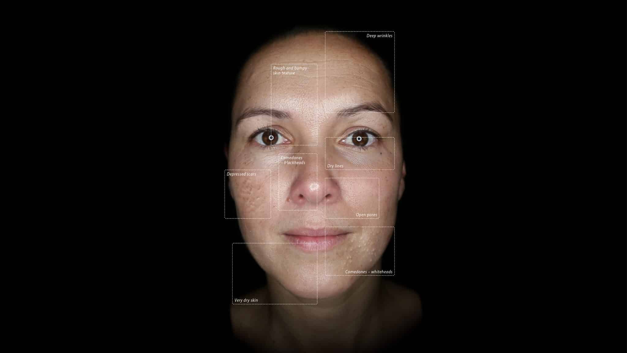Alma IQ Paralell Polarized Mode Callouts scaled 1