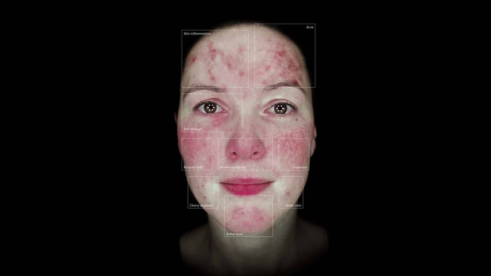 Alma IQ Vascularity Mode Callouts scaled 1