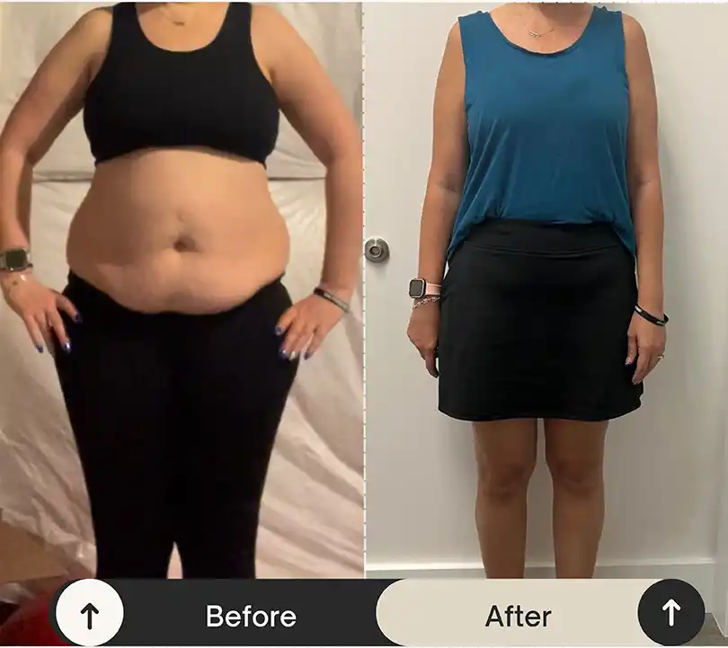 Weight Loss before - after